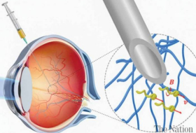 Учёные создали нанороботов, способных «просверлить» ткань глаза, не повредив её
