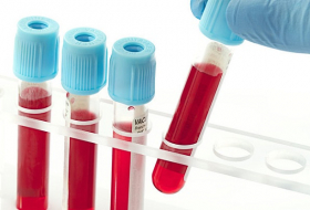 Ученые разработали суперанализ крови, который покажет большинство болезней