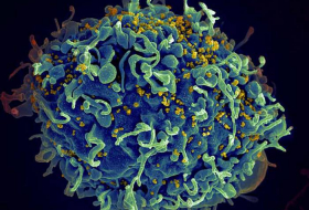 Французские ученые нашли способ уничтожать зараженные ВИЧ клетки
