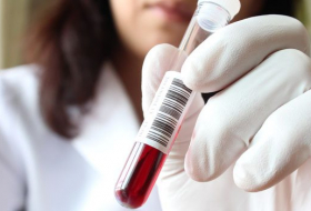 В Азербайджане будет решен вопрос нехватки лекарств для людей с заболеваниями крови
