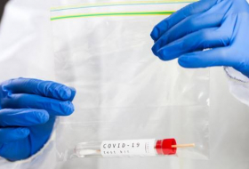 TƏBİB прокомментировало высказывания о нехватке тестов для выявления коронавируса
