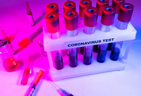 Количество заболевших коронавирусом в мире превысило 32 миллиона
