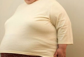 Свыше 8 % населения Азербайджана старше 15 лет страдают от ожирения
