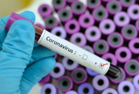 В Азербайджане еще 67 человек заразились коронавирусом
