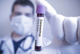 За последние сутки в Азербайджане коронавирусом заразились 101 человек
