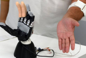 Ученые создали бионический имплантат, позволяющий контролировать все пальцы протеза
