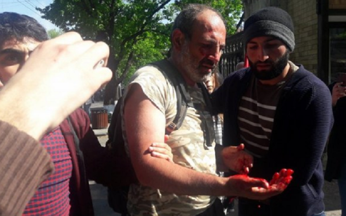 Полиция Армении жестоко избила депутата - ФОТО