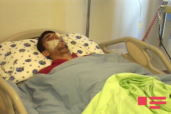 Врачи не смогли извлечь осколок из тела раненного армянами жителя Агджабеди 