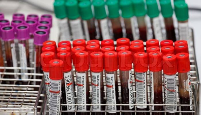 Ученые выяснили, с какой группой крови выше шанс умереть от травмы
