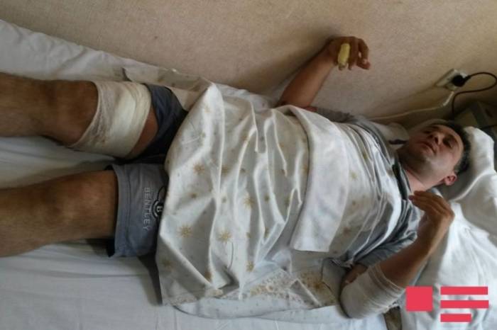 Раненный в Гяндже сотрудник полиции: «Мы не ожидали, что у них будут кинжал и другое холодное оружие» - ФОТО 
