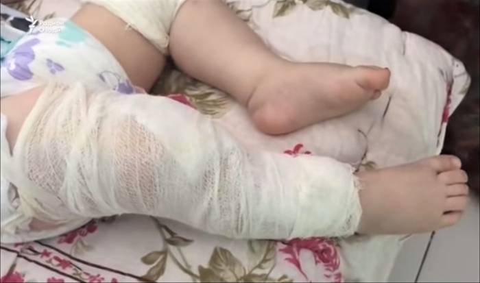 Иглы в 9-месячного таджикского младенца втыкала его мать
