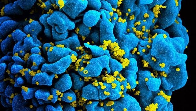Комбинация антител от ВИЧ прошла первое клиническое испытание