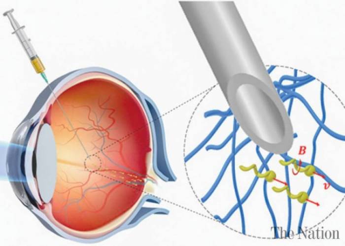Учёные создали нанороботов, способных «просверлить» ткань глаза, не повредив её
