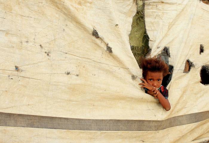 Болезни и голод за годы войны в Йемене унесли жизни свыше 700 тысяч человек
