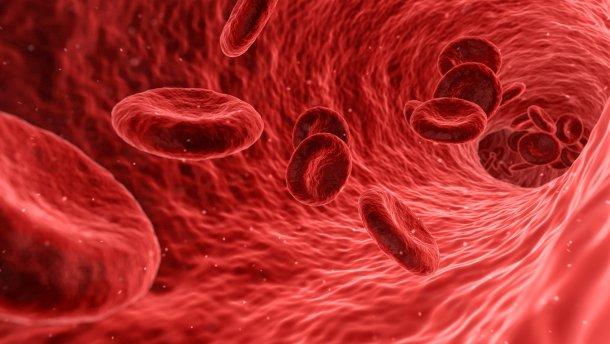 Причины необеспечения больных гемофилией факторами свертывания крови в Азербайджане

