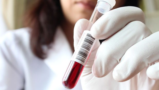 В Азербайджане будет решен вопрос нехватки лекарств для людей с заболеваниями крови
