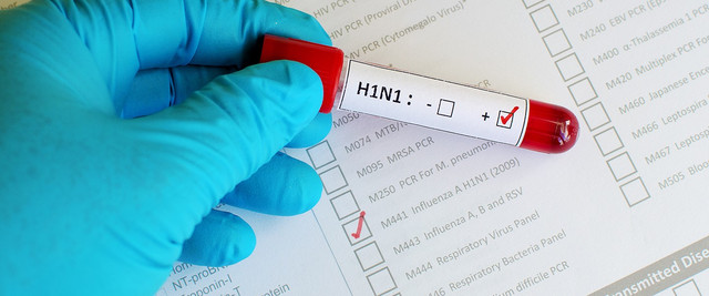 В Грузии зафиксированы два летальных исхода от вируса H1N1
