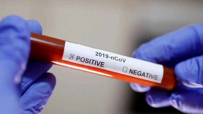 Израильские медики оценили тяжесть коронавируса
