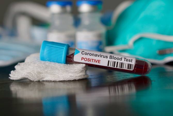 В Армении число зараженных коронавирусом лиц достигло 115