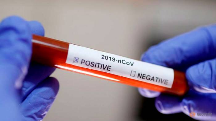 В Греции зафиксировали девятый случай заражения коронавирусом

