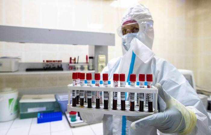 Россия вышла на восьмое место в мире по числу заразившихся коронавирусом

