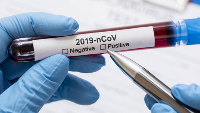 В Грузиии число подтвержденных случаев коронавируса увеличилось до 370