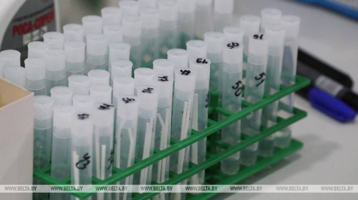 В Беларуси есть тест-системы для более чем 20 тыс. исследований на коронавирус