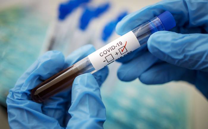 В Швейцарии число заразившихся коронавирусом достигло 23574 человек 