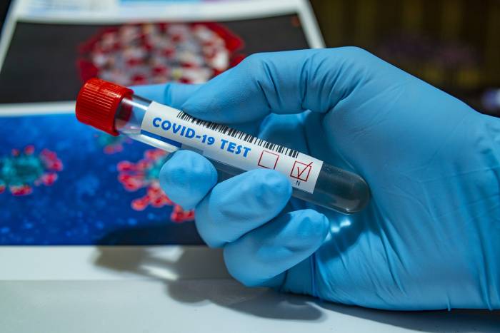 В Армении количество зараженных коронавирусом достигло 2619