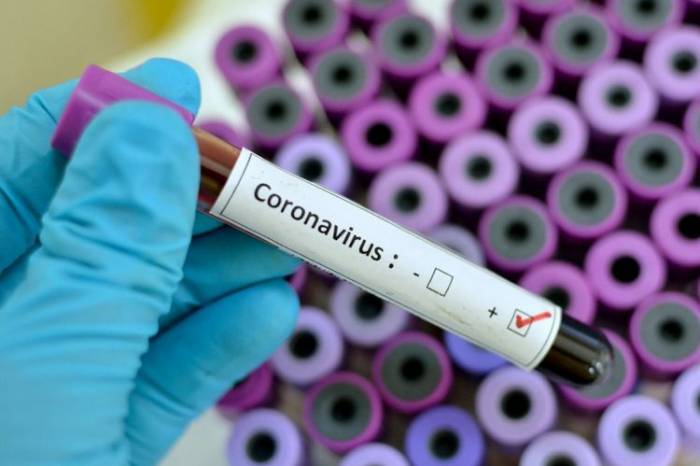 В Азербайджане проведено 461861 тестов на коронавирус