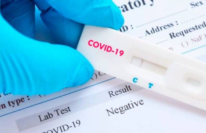 Стоимость тестов на коронавирус должна быть оптимизирована