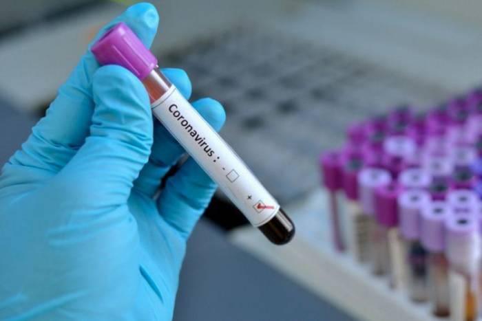 В Азербайджане обнародовано количество проведенных тестов на коронавирус
