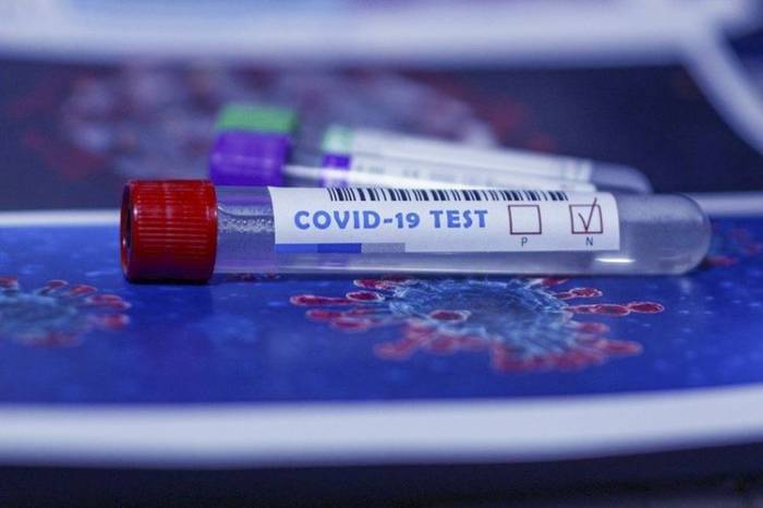 В Азербайджане проведено 1700654 теста на коронавирус
