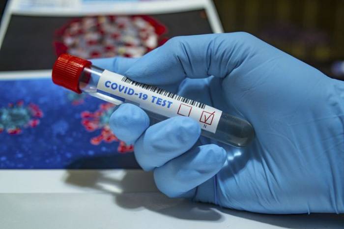 В Азербайджане проведено 1576060 тестов на коронавирус
