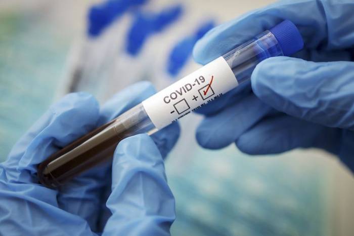 В Азербайджане число инфицированных коронавирусом достигло 87 163, скончались 1 079 человек
