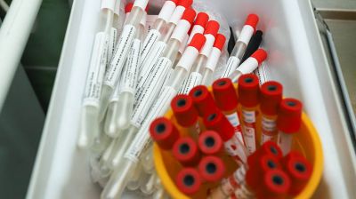 В мире за сутки зарегистрировали более 541 тыс. случаев заражения коронавирусом