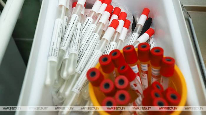 Более 468 тыс. случаев заражения коронавирусом выявлено в мире за сутки

