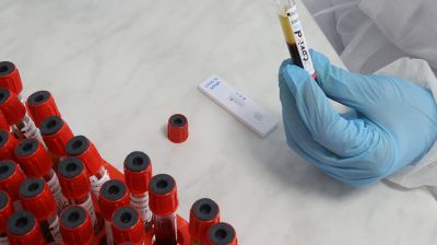 В Армении за последние сутки коронавирусом заразились 173 человека

