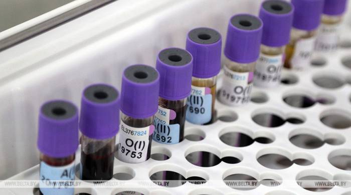 Более 494 тыс. случаев заражения коронавирусом выявили в мире за сутки
