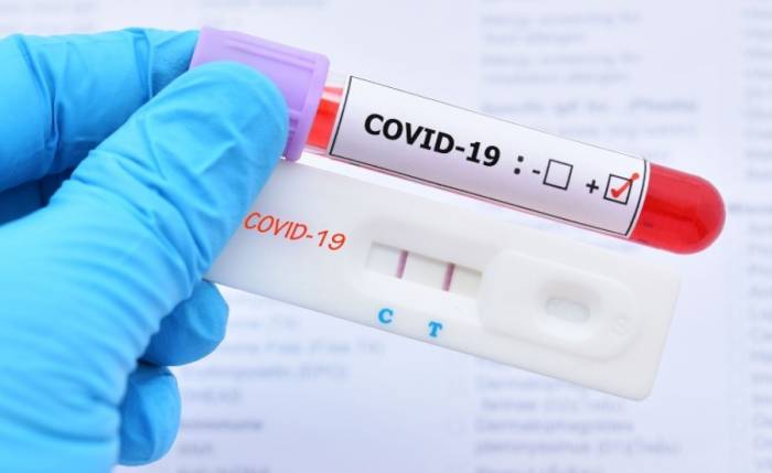 1105 новых случаев COVID-19 зарегистрировали в Казахстане