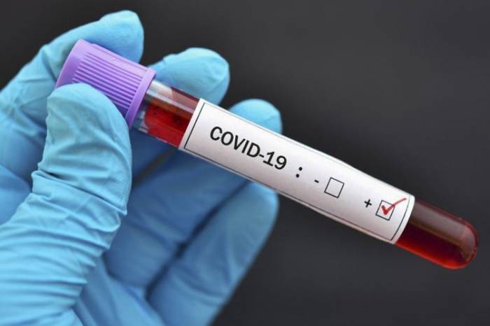 Число инфицированных коронавирусом в Грузии превысило 283 тыс. человек