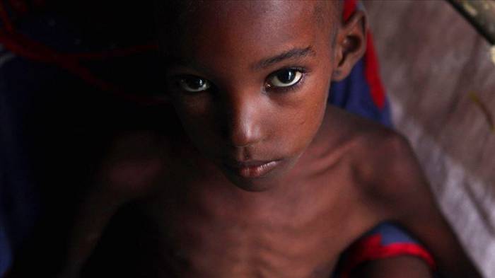 В Нигерии от недоедания умер 81 ребенок
