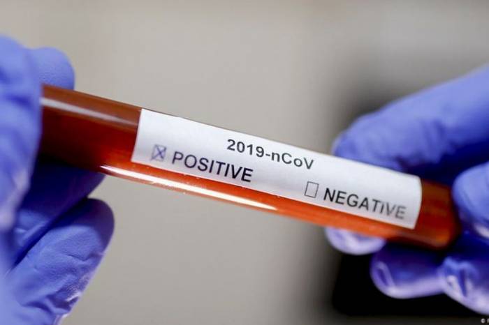 В Грузии выявлено 1 219 новых случаев инфицирования коронавирусом
