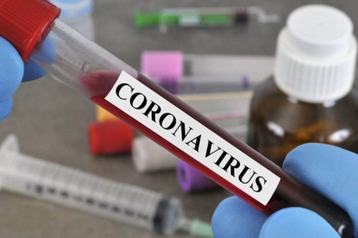 В Грузии за последние сутки коронавирусом заразились 723 человека