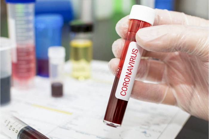 В Британии за последние сутки коронавирусом заразились 4182 человека
