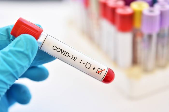 Обнародовано число заболевших коронавирусом 