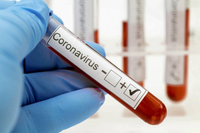 В России за последние сутки коронавирусом заразились 20 765 человек