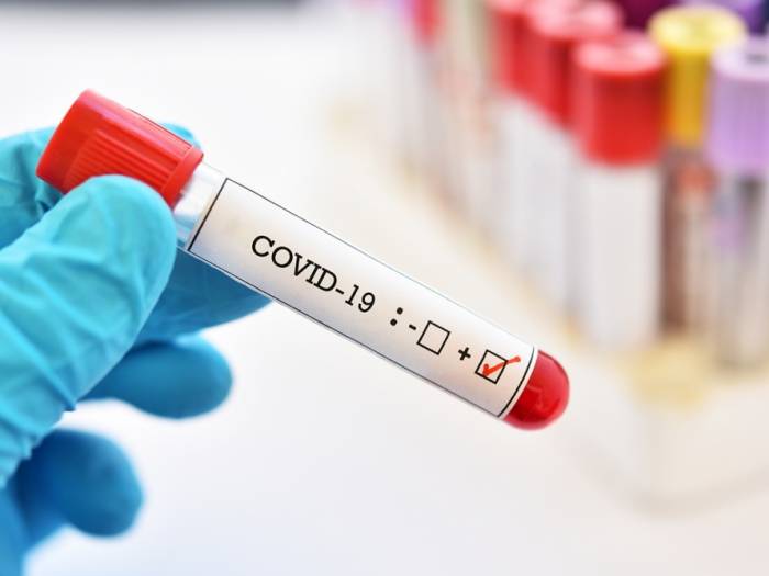 Чехия на втором месте в мире по уровню заболеваемости коронавирусом
