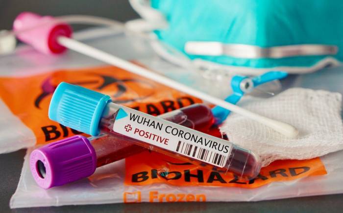 В Азербайджане за сутки коронавирусом заразились 1 406 человек