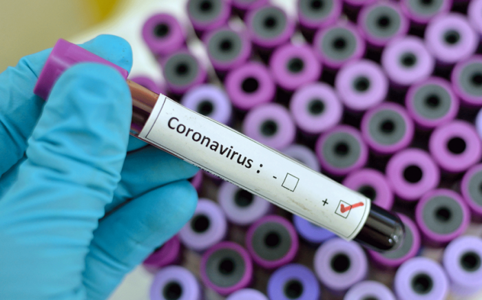 В Азербайджане за сутки выявлено 595 случаев заражения коронавирусом
